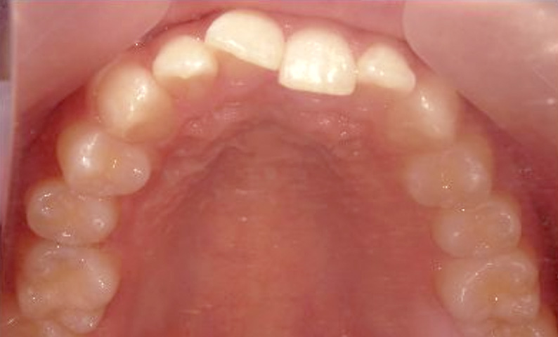 10代(18歳以上)の症例