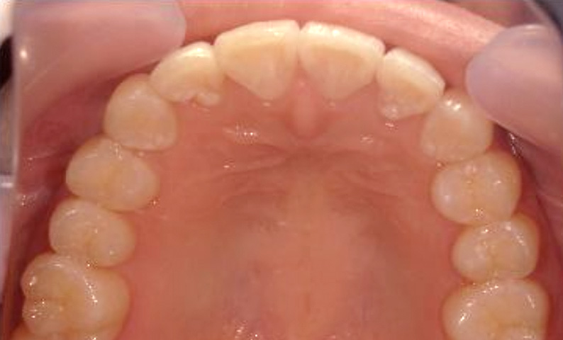 10代(18歳以上)の症例