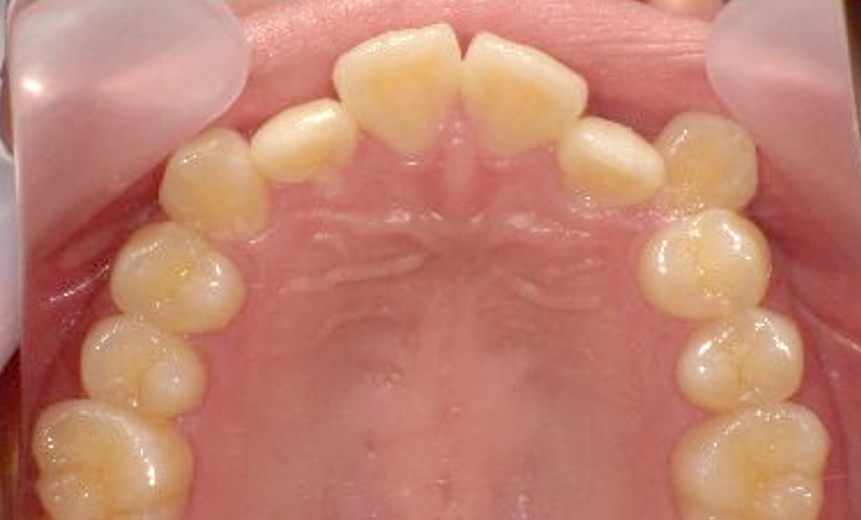 10代(18歳以上)の症例