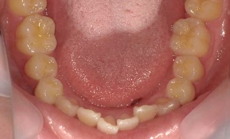 10代(18歳以上)の症例