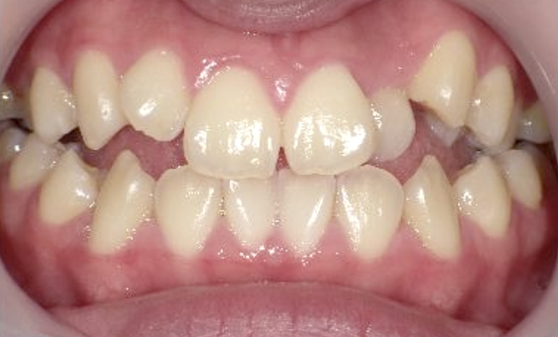 10代(18歳以上)の症例