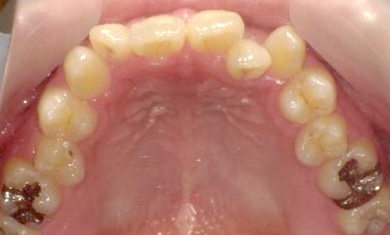 10代(18歳以上)の症例