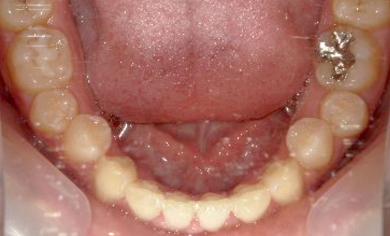 10代(18歳以上)の症例