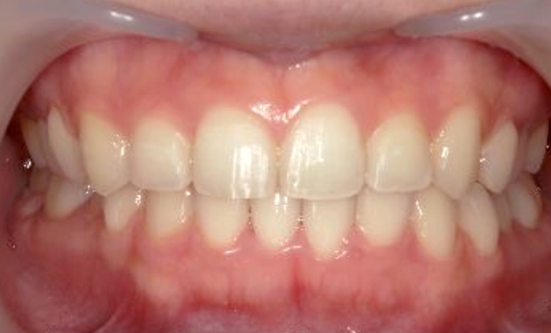 10代(18歳以上)の症例