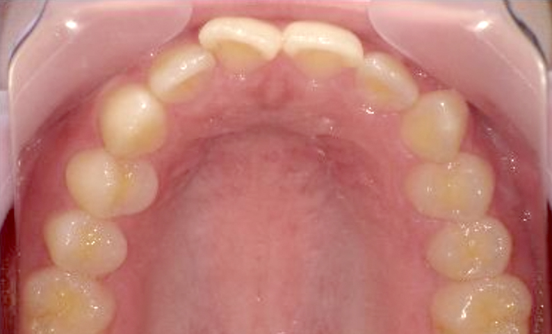 10代(18歳以上)の症例