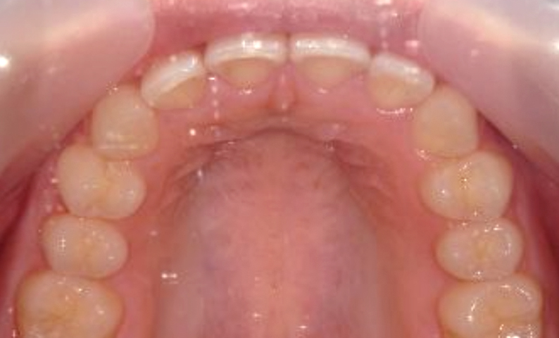 10代(18歳以上)の症例