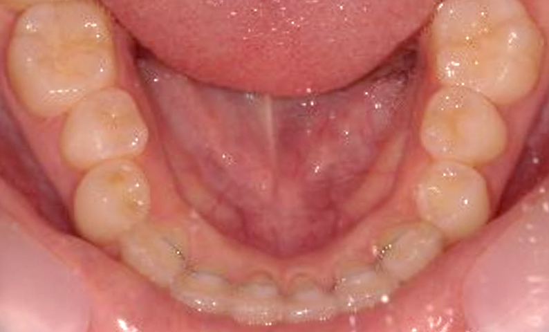 10代(18歳以上)の症例