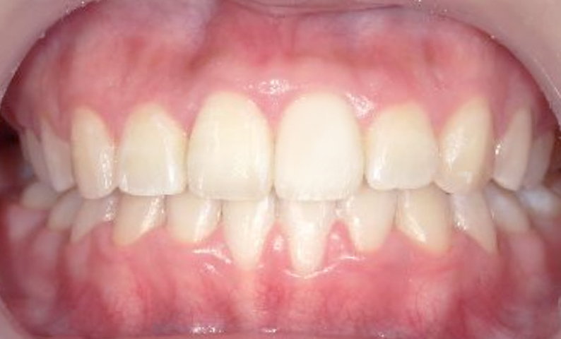 10代(18歳以上)の症例