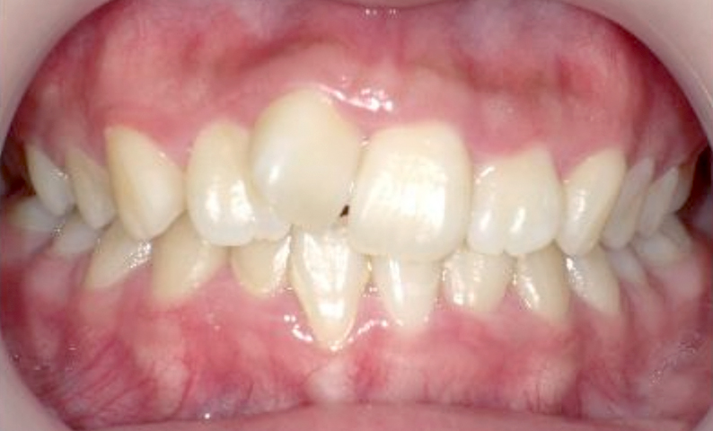 10代(18歳以上)の症例