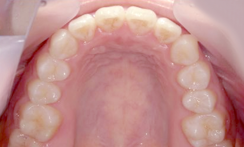 10代(18歳以上)の症例