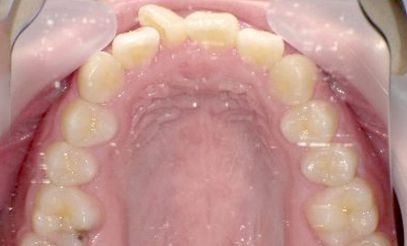 10代(18歳以上)の症例