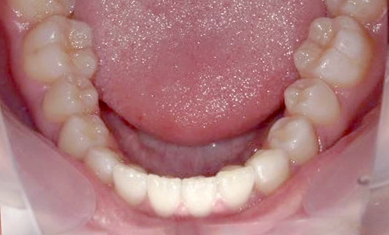 10代(18歳以上)の症例