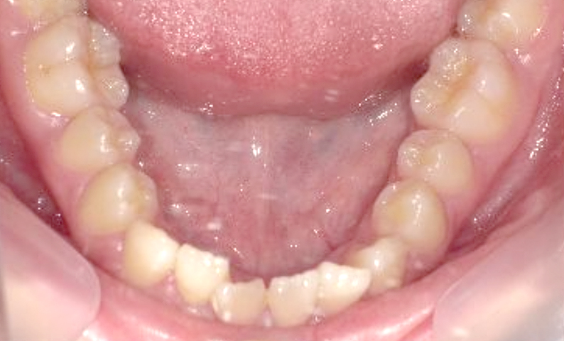 10代(18歳以上)の症例
