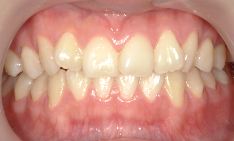 10代(18歳以上)の症例