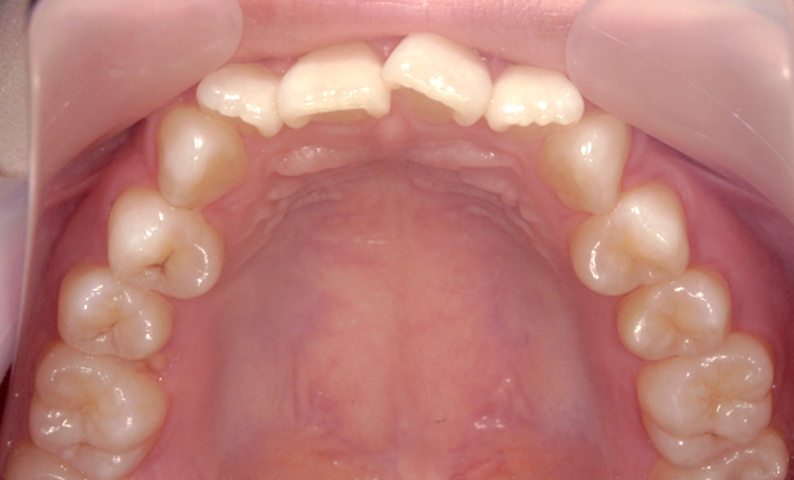 10代(18歳以上)の症例