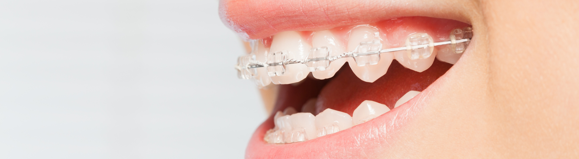 部分矯正のたつや歯科