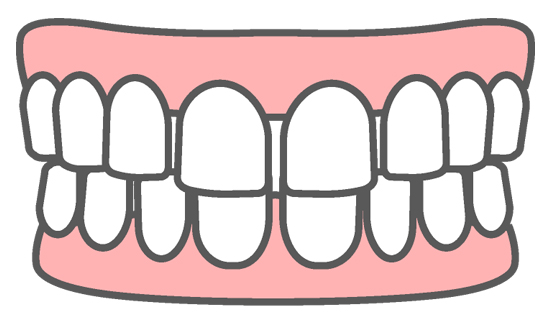部分矯正のたつや歯科