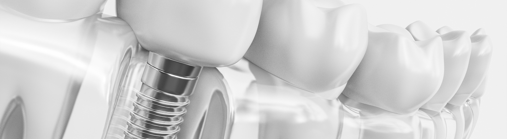 部分矯正のたつや歯科