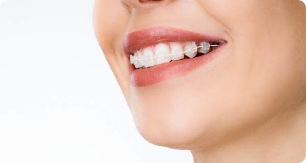 たつや歯科の部分矯正は明確・分かりやすい料金システム