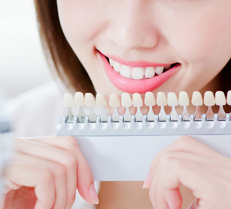 審美歯科 ホワイトニング