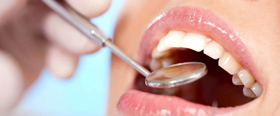 審美歯科 セラミック治療