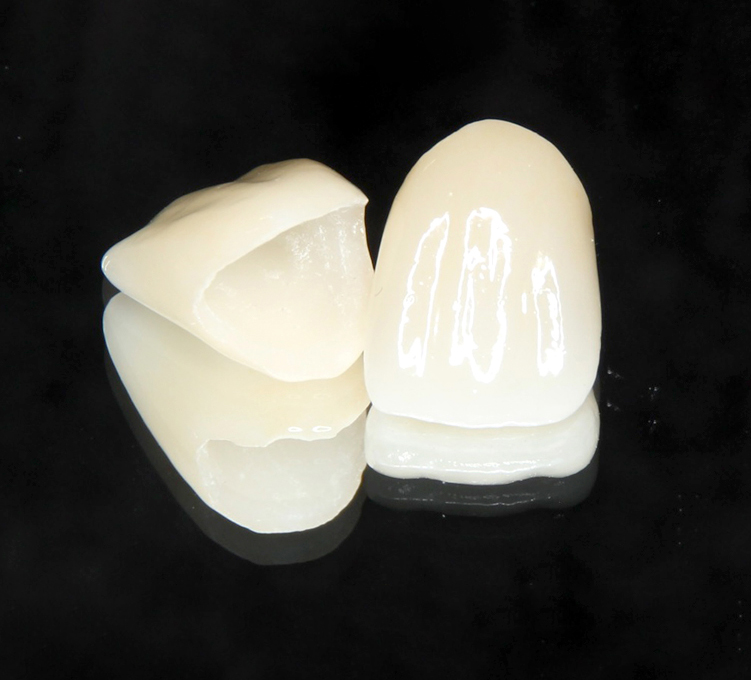 審美歯科 ホワイトニング