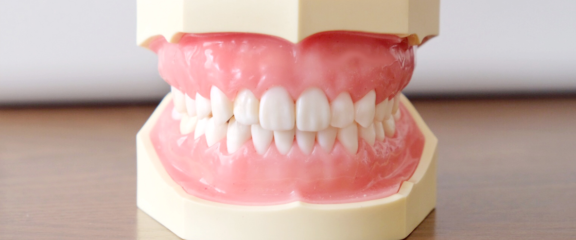 歯ぎしり・食いしばりの改善には咬筋ボツリヌス治療