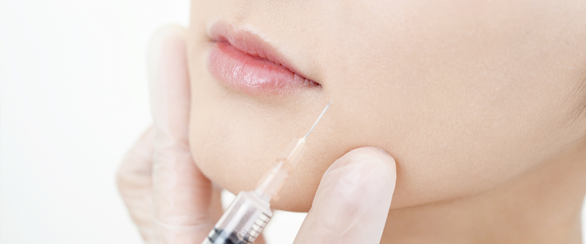 歯ぎしり・食いしばりの改善には咬筋ボツリヌス治療