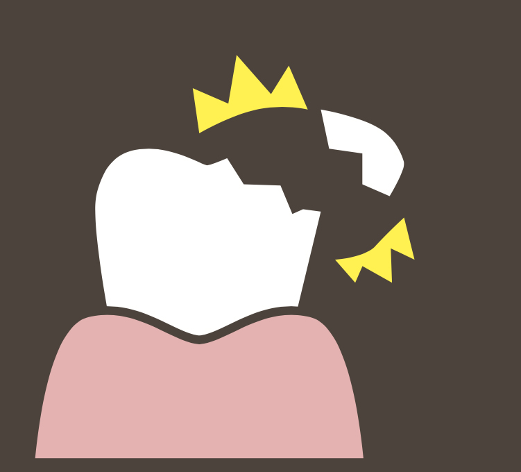 歯ぎしり・食いしばりが引き起こす全身への影響 歯に起こるトラブル